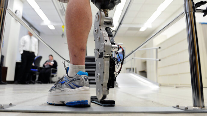 A patient tests out an experimental prosthetic leg at the Rehabilitation Institute of Chicago|Dr. Henry Betts