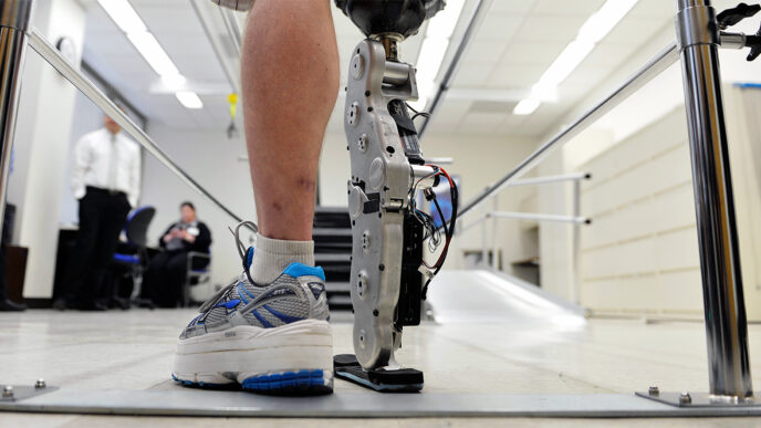 A patient tests out an experimental prosthetic leg at the Rehabilitation Institute of Chicago|Dr. Henry Betts